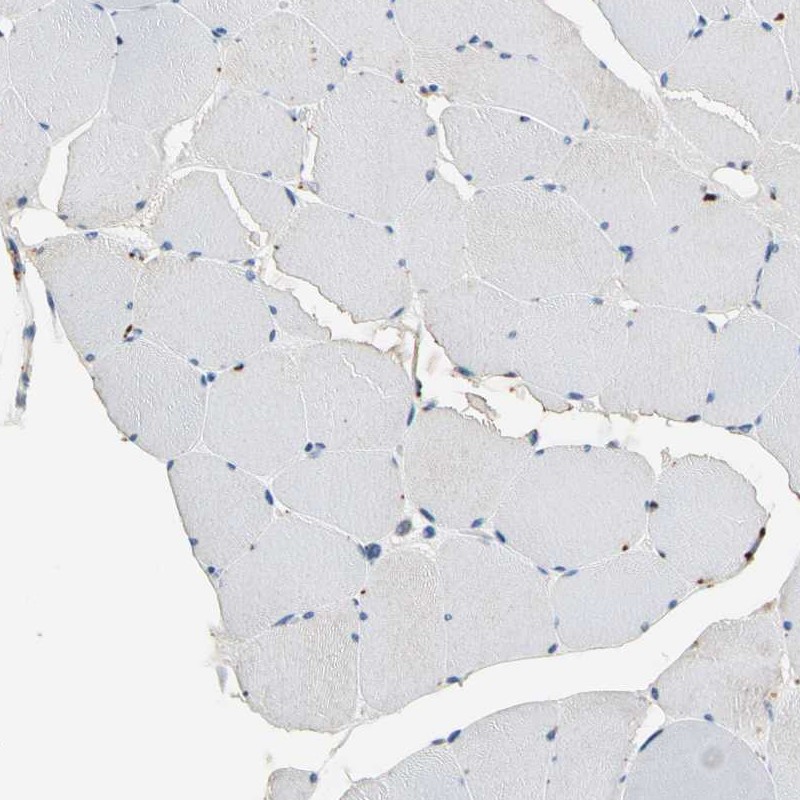 Immunohistochemistry (Formalin/PFA-fixed paraffin-embedded sections) - Anti-GM2A antibody (AB224246), expandable thumbnail