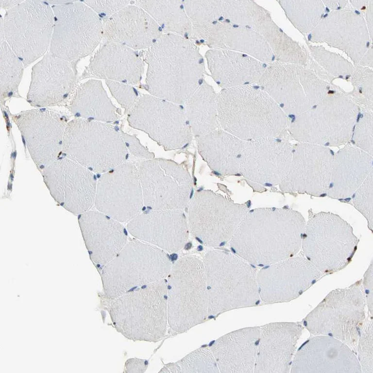 Immunohistochemistry (Formalin/PFA-fixed paraffin-embedded sections) - Anti-GM2A antibody (AB224246)