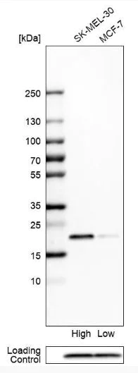 Western blot - Anti-GM2A antibody (AB224246)