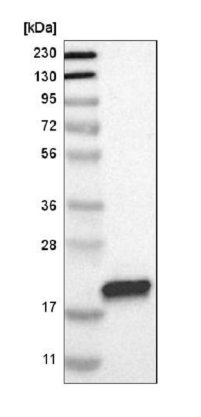 Western blot - Anti-GM2A antibody (AB224246), expandable thumbnail