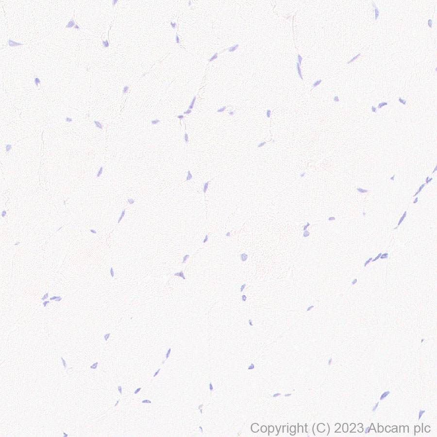 Immunohistochemistry (Formalin/PFA-fixed paraffin-embedded sections) - Anti-GM2A antibody [EPR28371-75] (ab313587), expandable thumbnail