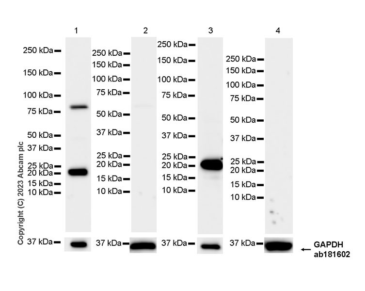 Western blot - Anti-GM2A antibody [EPR28371-75] (AB313587), expandable thumbnail
