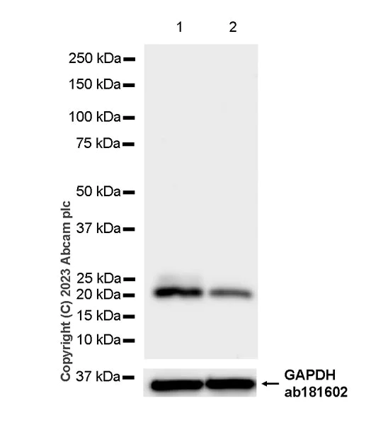 Western blot - Anti-GM2A antibody [EPR28371-75] - BSA and Azide free (AB313588)