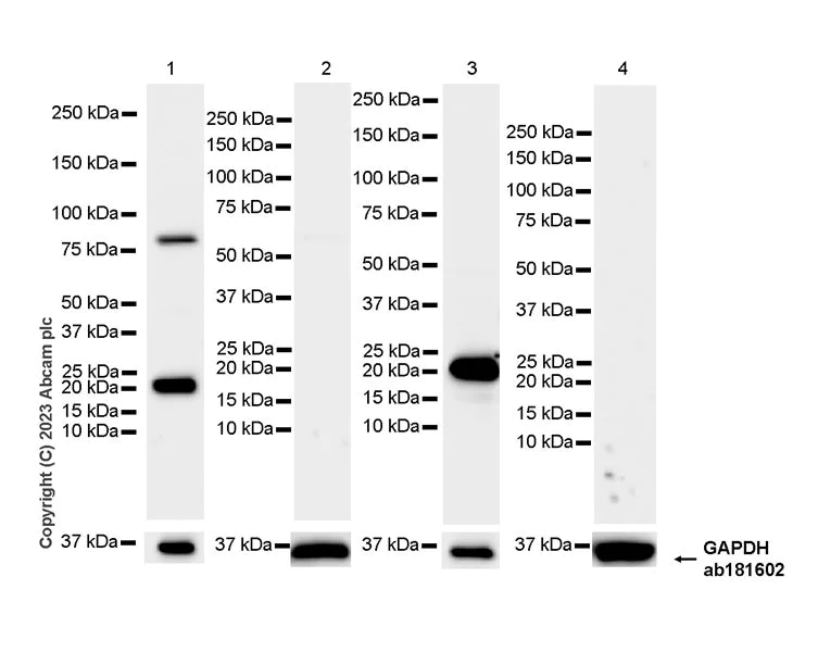 Western blot - Anti-GM2A antibody [EPR28371-75] - BSA and Azide free (AB313588)
