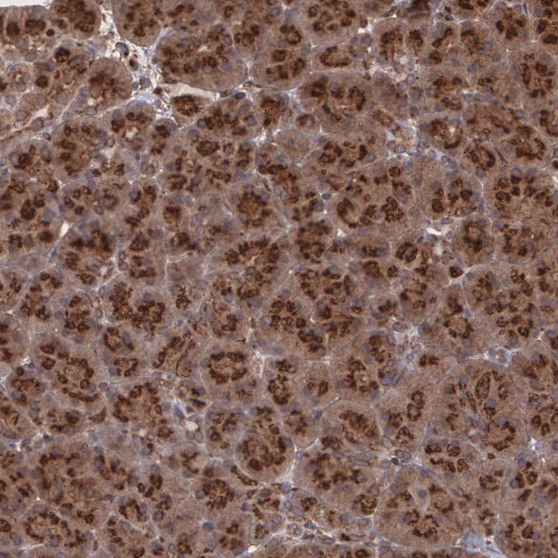Immunohistochemistry (Formalin/PFA-fixed paraffin-embedded sections) - Anti-GMAP-210 antibody (AB251664), expandable thumbnail