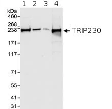 Western blot - Anti-GMAP-210 antibody (AB72223)