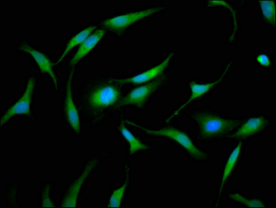 Immunocytochemistry/ Immunofluorescence - Anti-GMDS antibody (AB238613), expandable thumbnail