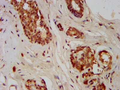 Immunohistochemistry (Formalin/PFA-fixed paraffin-embedded sections) - Anti-GMDS antibody (AB238613), expandable thumbnail