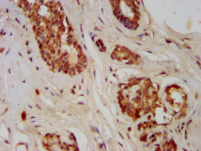 Immunohistochemistry (Formalin/PFA-fixed paraffin-embedded sections) - Anti-GMDS antibody (AB238613)