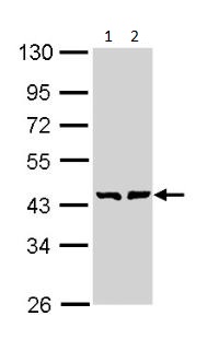 Western blot - Anti-GMDS antibody (AB97630), expandable thumbnail