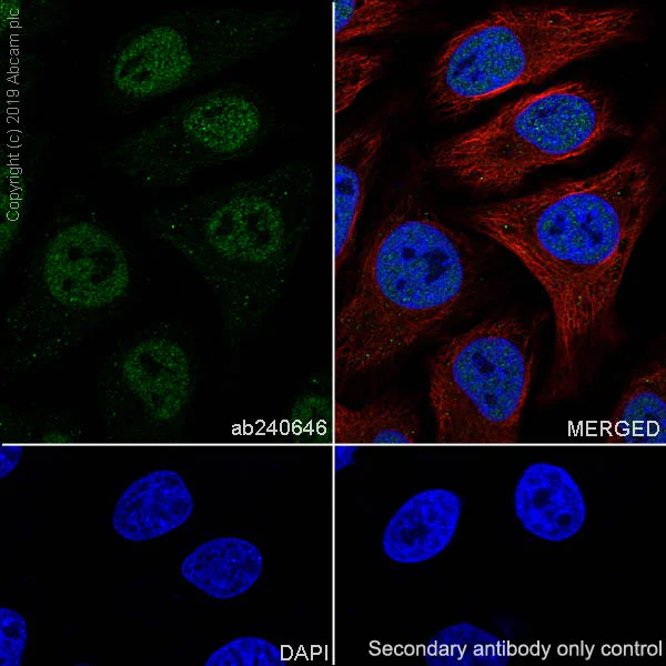 Immunocytochemistry/ Immunofluorescence - Anti-GMEB1 antibody [EPR23056-62] (AB240646)