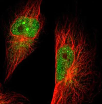Immunocytochemistry/ Immunofluorescence - Anti-GMFB antibody (AB224322)