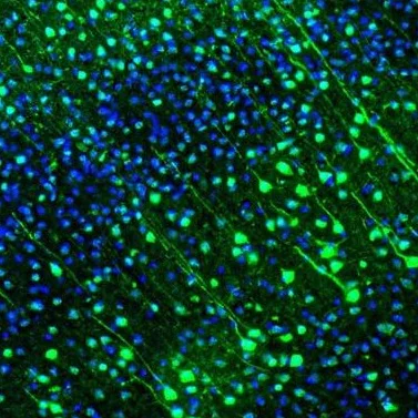 Immunohistochemistry (Formalin/PFA-fixed paraffin-embedded sections) - Anti-GMFB antibody (AB224322)