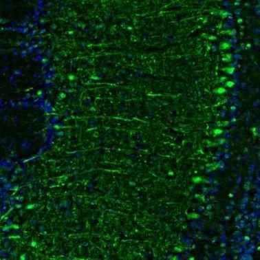 Immunohistochemistry (Formalin/PFA-fixed paraffin-embedded sections) - Anti-GMFB antibody (AB224322)