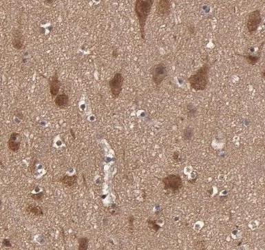 Immunohistochemistry (Formalin/PFA-fixed paraffin-embedded sections) - Anti-GMFB antibody (AB224322)