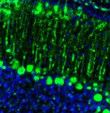 Immunohistochemistry (Formalin/PFA-fixed paraffin-embedded sections) - Anti-GMFB antibody (AB224322)