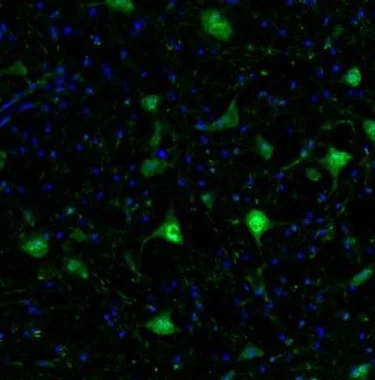 Immunohistochemistry (Formalin/PFA-fixed paraffin-embedded sections) - Anti-GMFB antibody (AB224322)