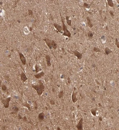 Immunohistochemistry (Formalin/PFA-fixed paraffin-embedded sections) - Anti-GMFB antibody (AB224322)