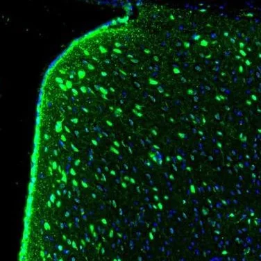 Immunohistochemistry (Formalin/PFA-fixed paraffin-embedded sections) - Anti-GMFB antibody (AB224322)