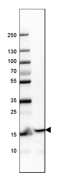 Western blot - Anti-GMFB antibody (AB224322)