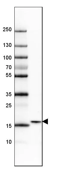 Western blot - Anti-GMFB antibody (AB224322)