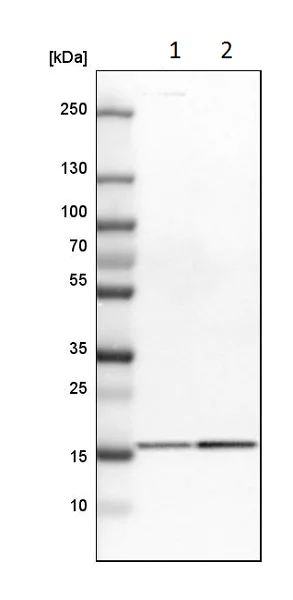 Western blot - Anti-GMFB antibody (AB224322)