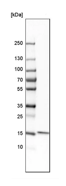 Western blot - Anti-GMFB antibody (AB224322)