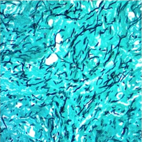 Immunohistochemistry - GMS Stain Kit (AB287884)