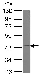 Western blot - Anti-GNA11 antibody (AB153951), expandable thumbnail