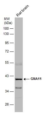 Western blot - Anti-GNA11 antibody (AB153951), expandable thumbnail