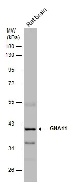 Western blot - Anti-GNA11 antibody (AB153951)