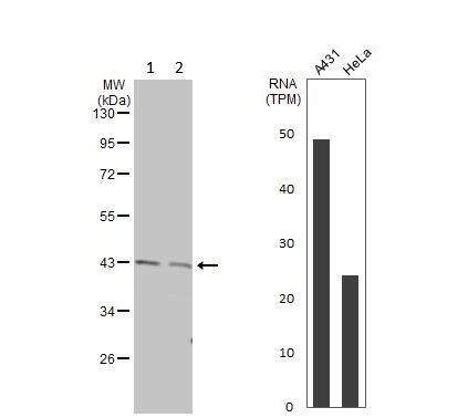 Western blot - Anti-GNA11 antibody (AB153951)