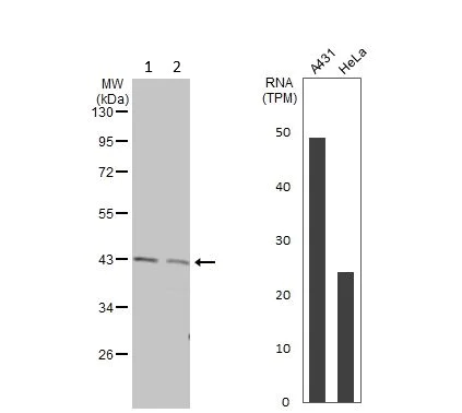 Western blot - Anti-GNA11 antibody (AB153951)