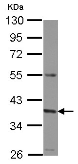 Western blot - Anti-GNA11 antibody (AB153951), expandable thumbnail