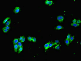 Immunocytochemistry/ Immunofluorescence - Anti-GNA11 antibody (AB234822)