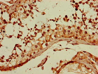 Immunohistochemistry (Formalin/PFA-fixed paraffin-embedded sections) - Anti-GNA11 antibody (AB234822)