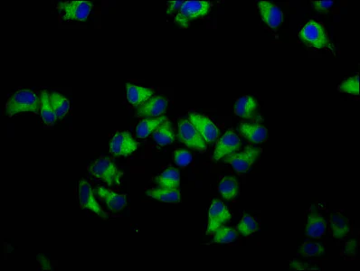 Immunocytochemistry/ Immunofluorescence - Anti-GNA12 antibody (AB236617)