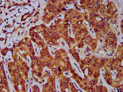 Immunohistochemistry (Formalin/PFA-fixed paraffin-embedded sections) - Anti-GNA12 antibody (AB236617), expandable thumbnail