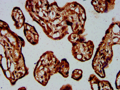 Immunohistochemistry (Formalin/PFA-fixed paraffin-embedded sections) - Anti-GNA12 antibody (AB236617), expandable thumbnail