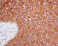Immunohistochemistry (Formalin/PFA-fixed paraffin-embedded sections) - Anti-GNA13 antibody [EPR5436] (ab128900), expandable thumbnail