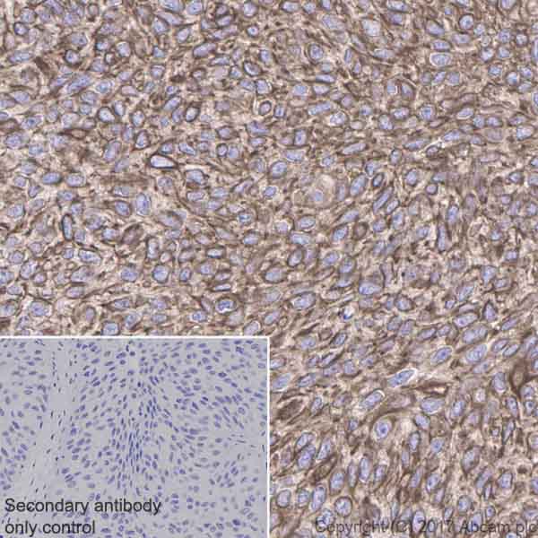 Immunohistochemistry (Formalin/PFA-fixed paraffin-embedded sections) - Anti-GNA13 antibody [EPR5436] (AB128900), expandable thumbnail