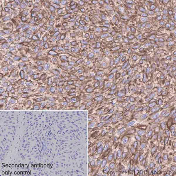 Immunohistochemistry (Formalin/PFA-fixed paraffin-embedded sections) - Anti-GNA13 antibody [EPR5436] (AB128900)
