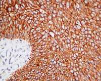 Immunohistochemistry (Formalin/PFA-fixed paraffin-embedded sections) - Anti-GNA13 antibody [EPR5436] - BSA and Azide free (AB232478)