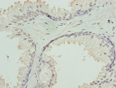 Immunohistochemistry (Formalin/PFA-fixed paraffin-embedded sections) - Anti-GNA14 antibody (AB236095)
