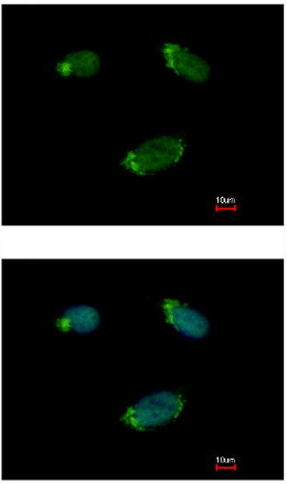 Immunocytochemistry/ Immunofluorescence - Anti-GNA15 antibody (AB154157), expandable thumbnail