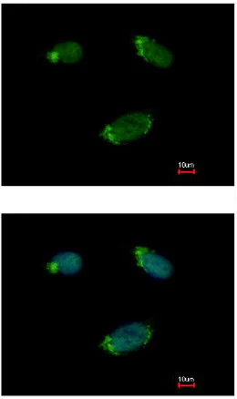 Immunocytochemistry/ Immunofluorescence - Anti-GNA15 antibody (AB154157)