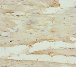 Immunohistochemistry (Formalin/PFA-fixed paraffin-embedded sections) - Anti-GNA15 antibody (AB225949)