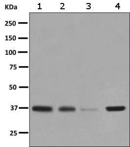 Western blot - Anti-GNAI1 antibody [EPR9441(B)] (AB140125)