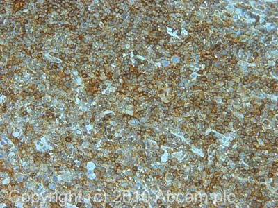 Immunohistochemistry (Formalin/PFA-fixed paraffin-embedded sections) - Anti-GNAI1 + GNAI2 antibody (AB3522)