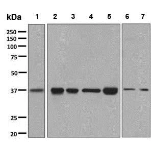 Western blot - Anti-GNAI2 antibody [EPR9468] (AB137050)